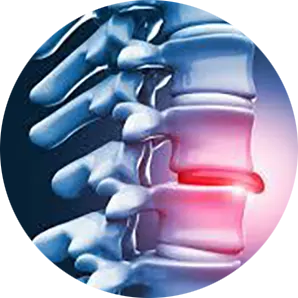 Disc Injury Chiropractor Near Me In Farragut and Loudon, TN